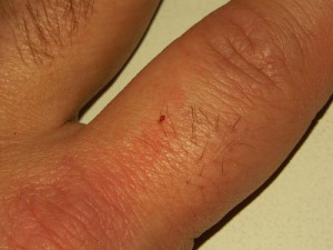 how big is a bedbug 2